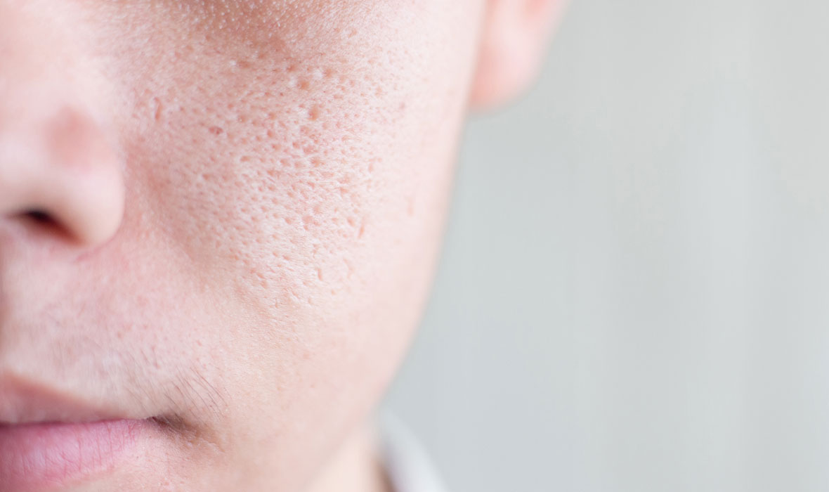 Proven Ways to Make Rough Skin Feel Smooth